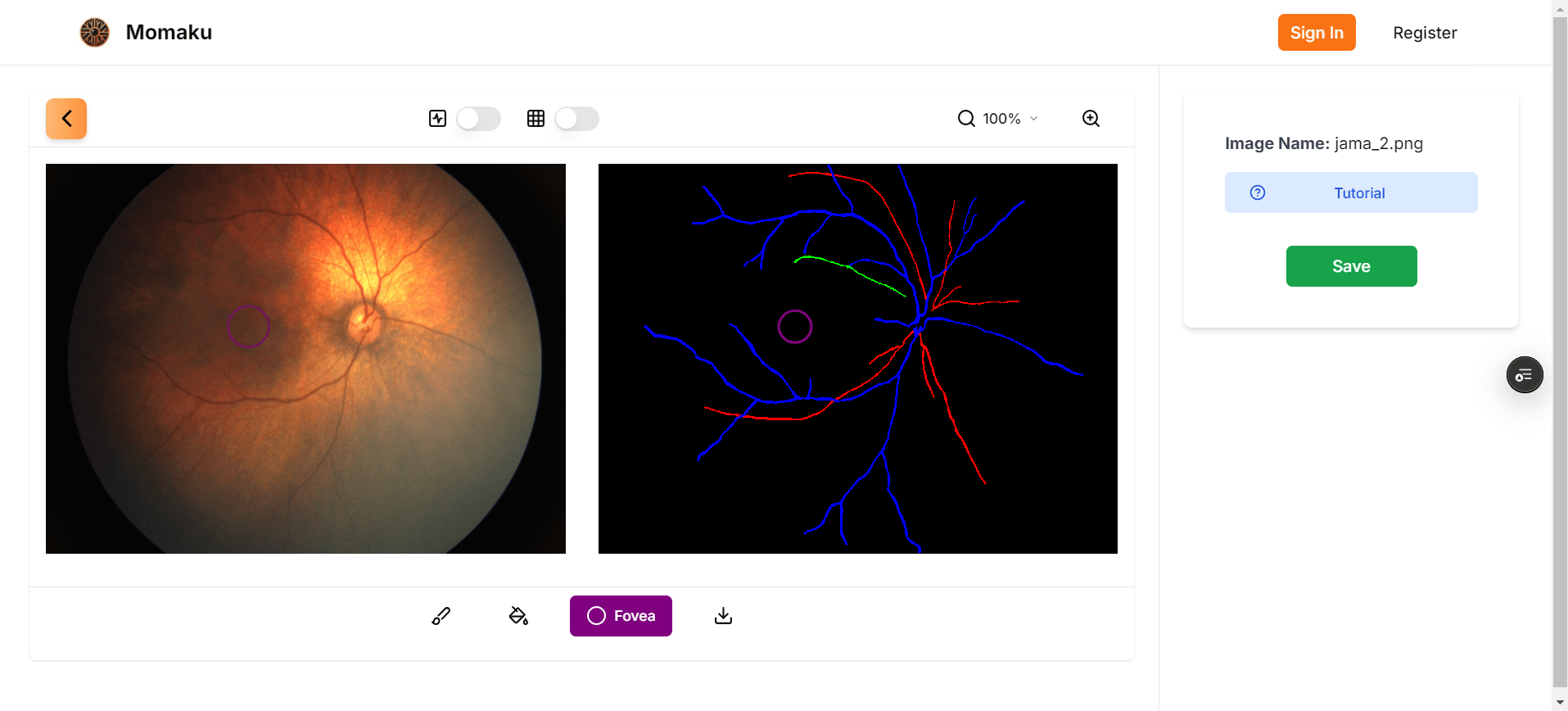 preview of annotation features