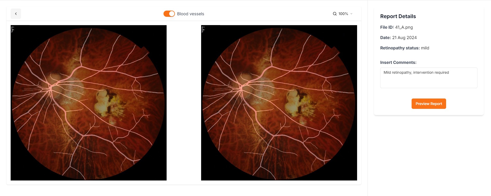 annotation dashboard preview